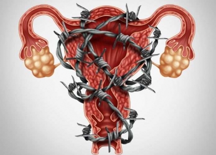 Endomarch para visibilizar la Endometriosis