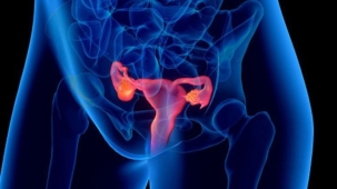 Endometriosis Profunda: La Cirugía